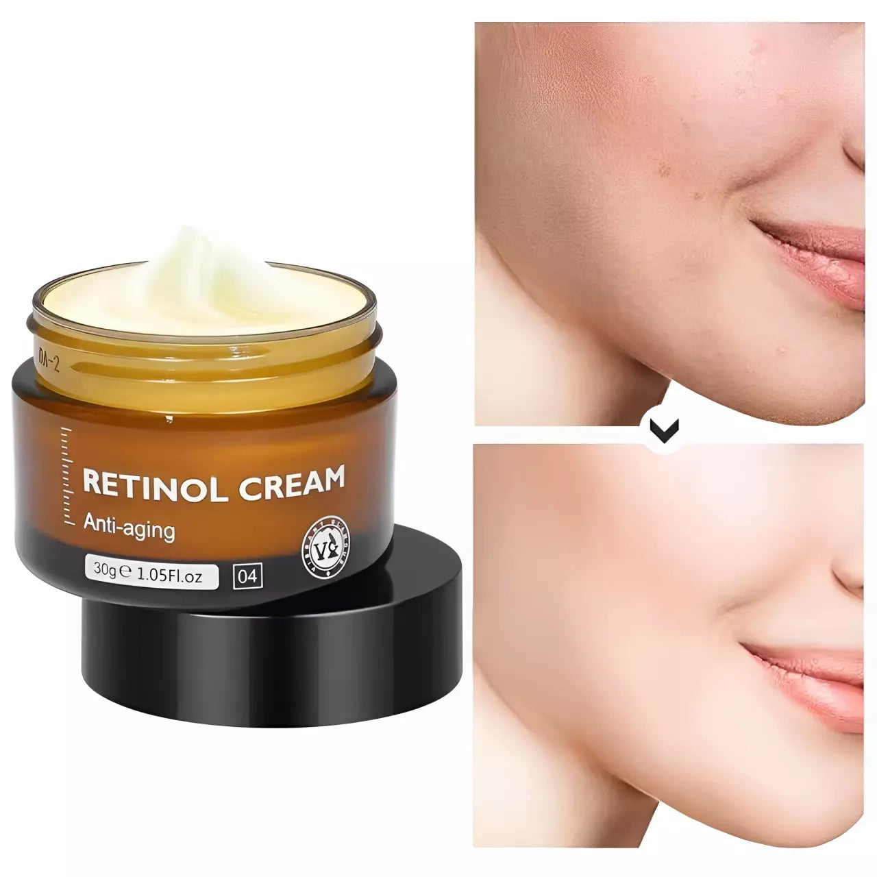 Kit 3 Retinol Cream - Hidratante e Anti Idade - Para Todos os Tipos de Pele
